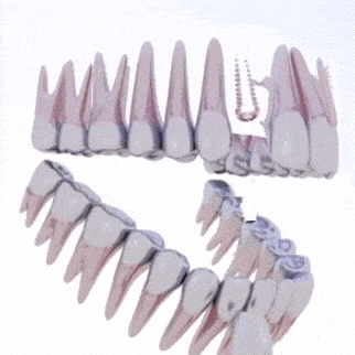 Dental implants in mumbai